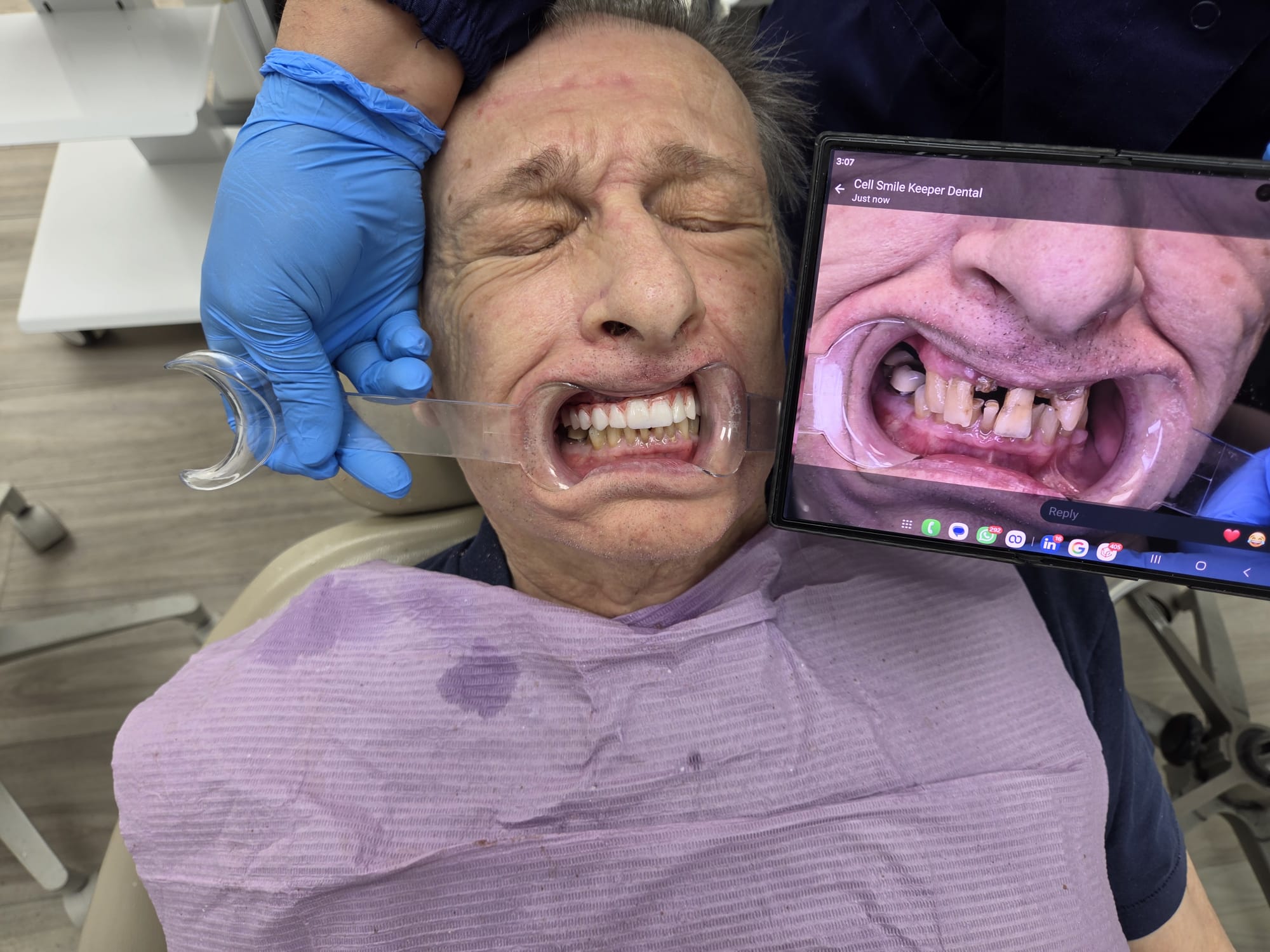 Dental implant result 1