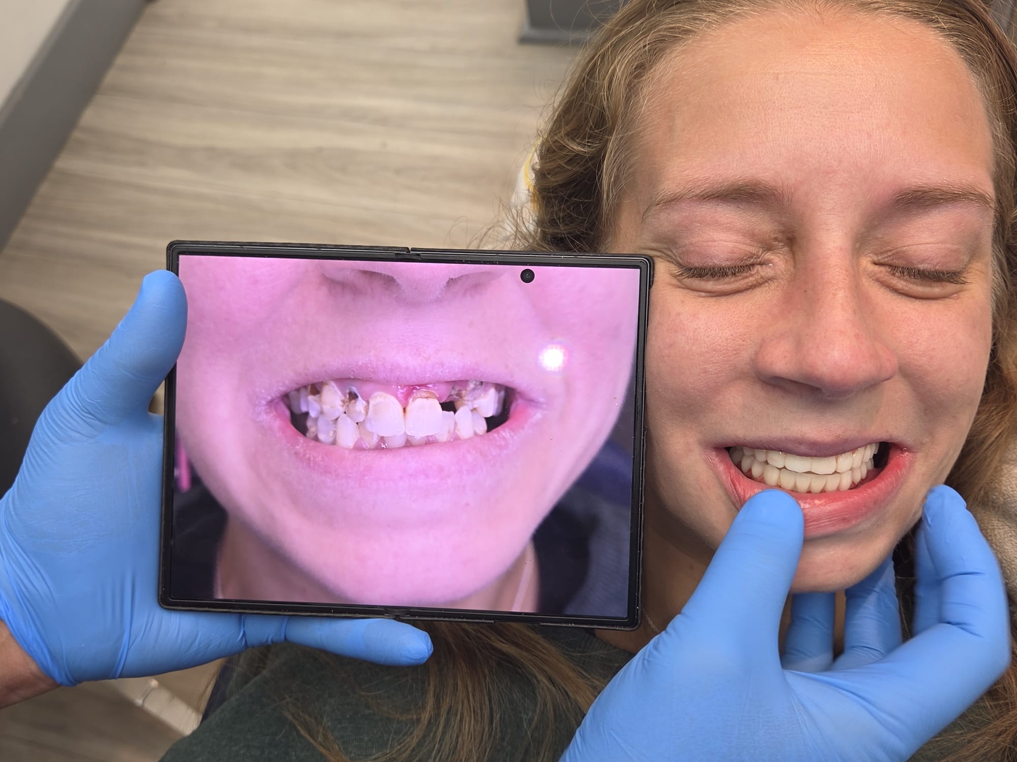 Dental implant result 3