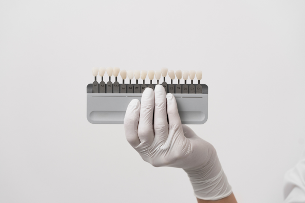 Porcelain Veneers Services