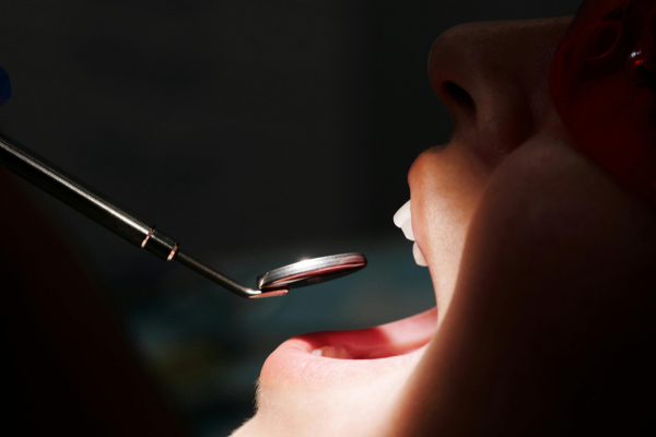 Zoom Whitening Services
