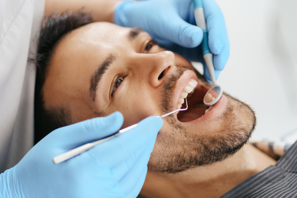Fillings and Restorations Services