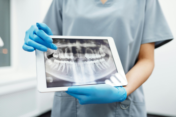 Non-Surgical Root Canal Services